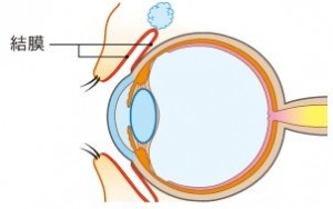 目の結膜　イラスト